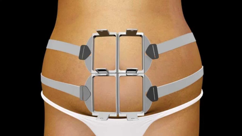 Non-Invasive Body Contouring Device